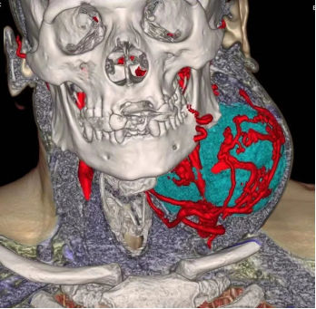 from clipboard from clipboard